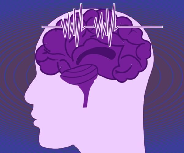 Best Doctor for Epilepsy in India - Dr. Praveen Gupta