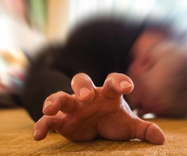 Epilepsy Specialist in Gurgaon - Expert Care by Dr Praveen Gupta